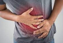 صحة الأمعاء